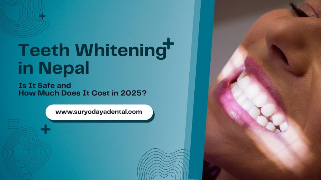 Teeth whitening in Nepal
